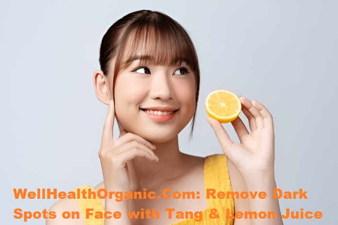 WellHealthOrganic.Com: Remove Dark Spots on Face with Tang & Lemon Juice